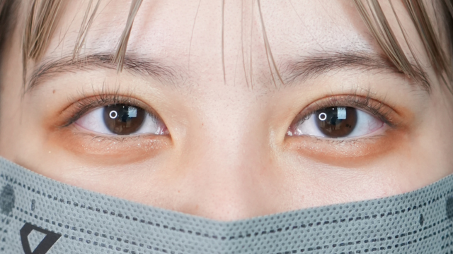 手術前の状態 その1