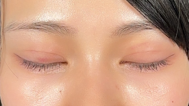 手术前的状态 其一