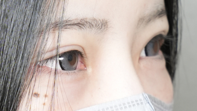 手術前の状態 その1