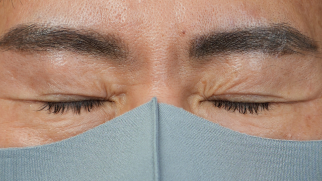 手术前的状态 其一