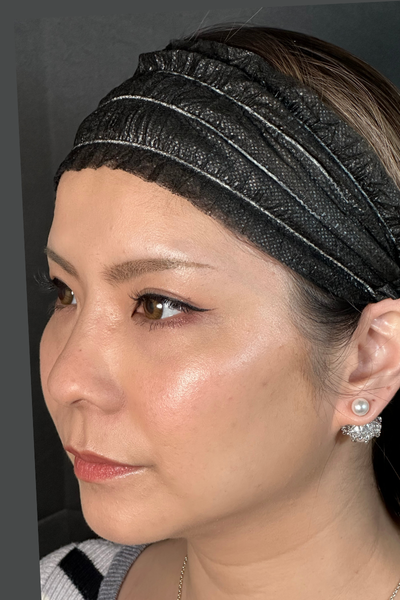 手术前的状态 其一