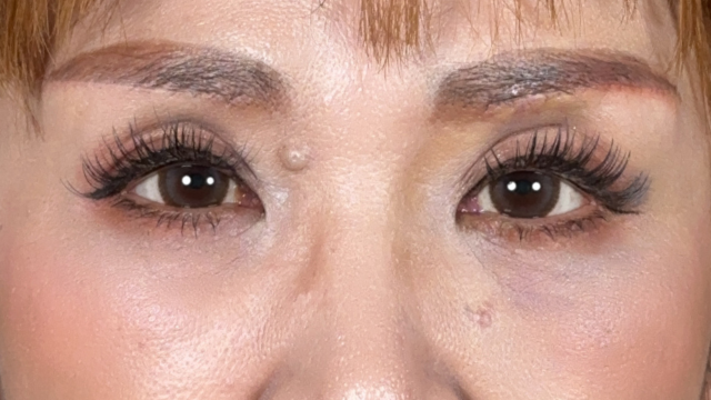 Postoperative Condition Part 1