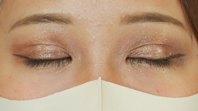 手術前の状態 その1