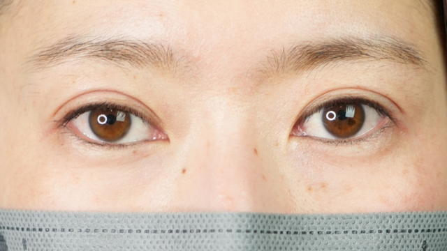 手术前的状态 其一