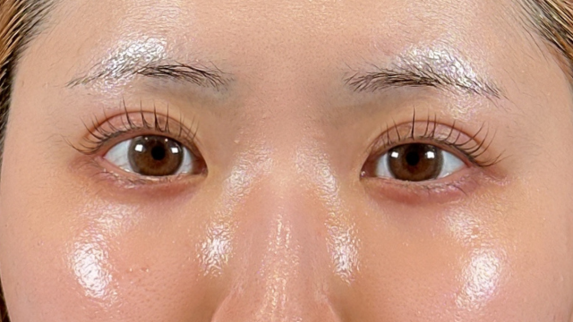 手術前の状態 その1