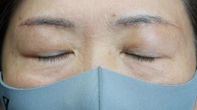 Postoperative Condition Part 1