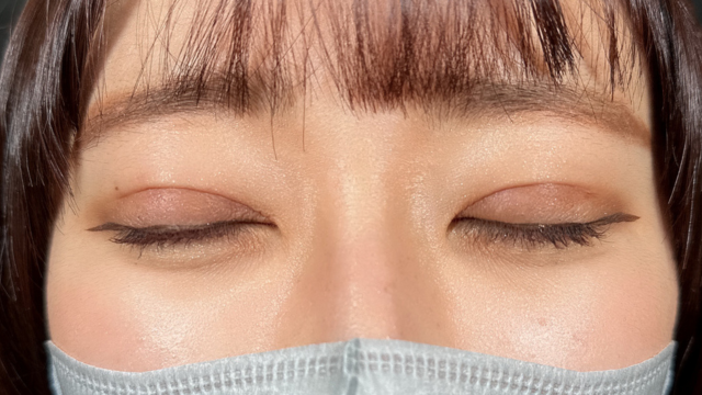 手术前的状态 其一