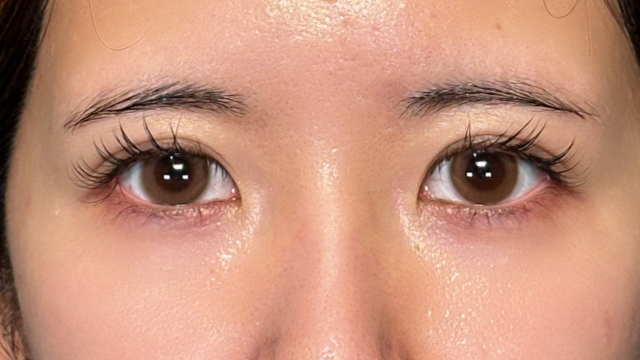 手术前的状态 其一