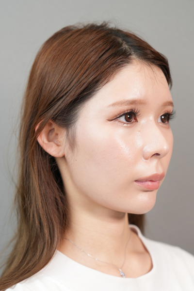 手術前の状態 その1