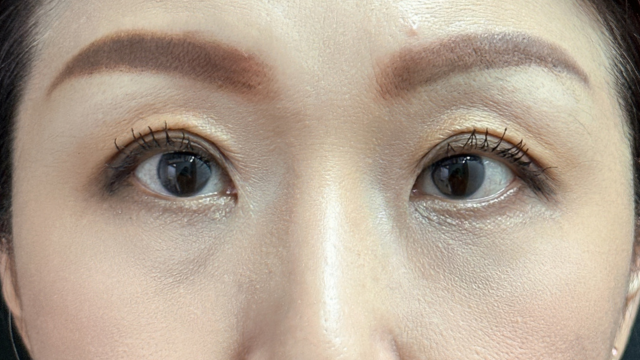 Postoperative Condition Part 1