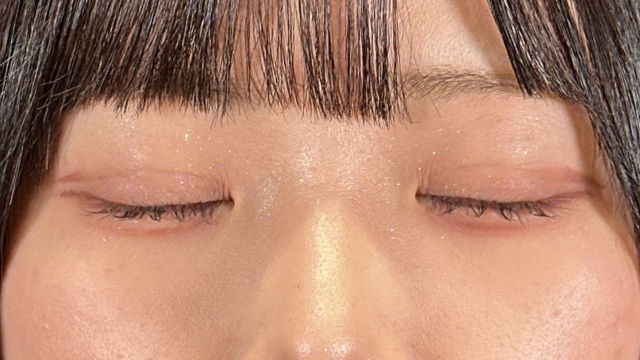 手術前の状態 その1