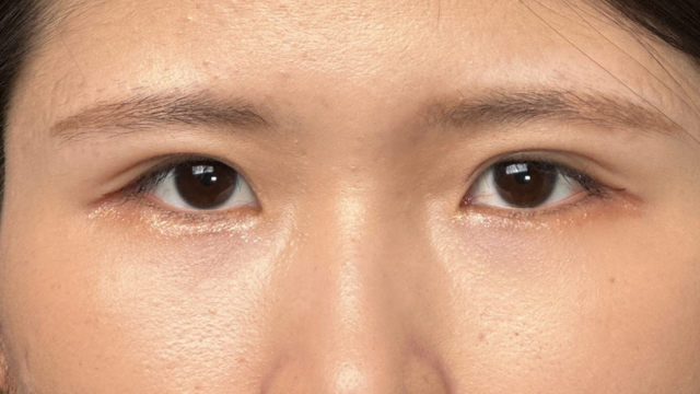 Postoperative Condition Part 1