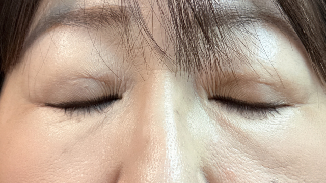 手术前的状态 其一