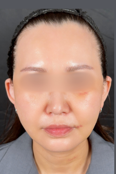 手术前的状态 其一