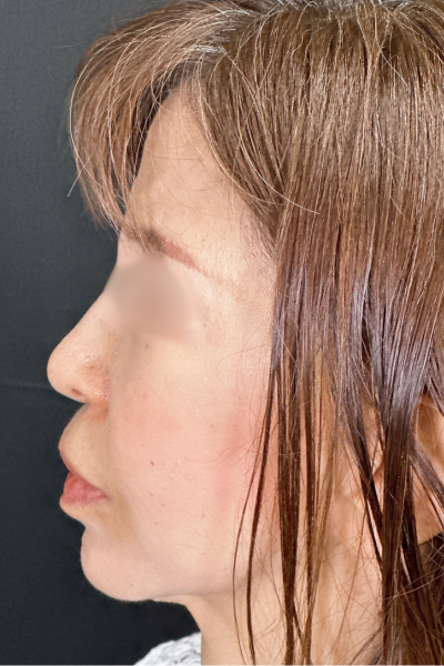 手術前の状態 その1