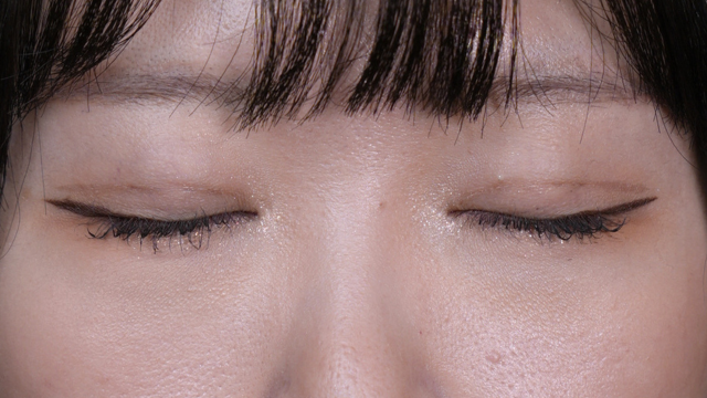 手术前的状态 其一