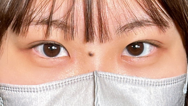 手术前的状态 其一