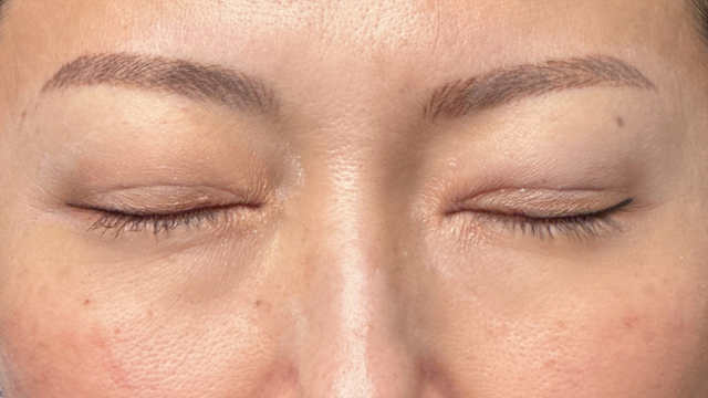 手术前的状态 其一