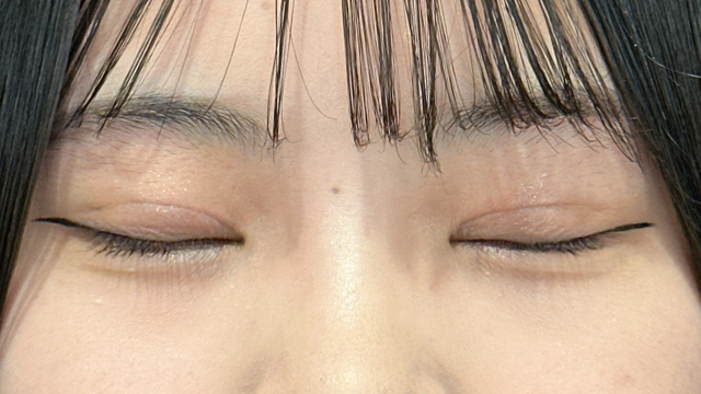 Postoperative Condition Part 1