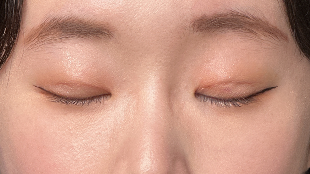 Postoperative Condition Part 1