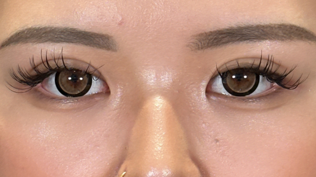 手術前の状態 その1