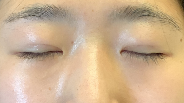 Postoperative Condition Part 1