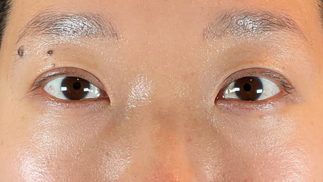 Postoperative Condition Part 1