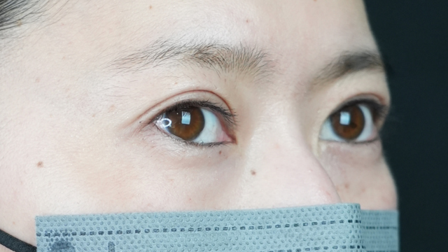 手术前的状态 其一