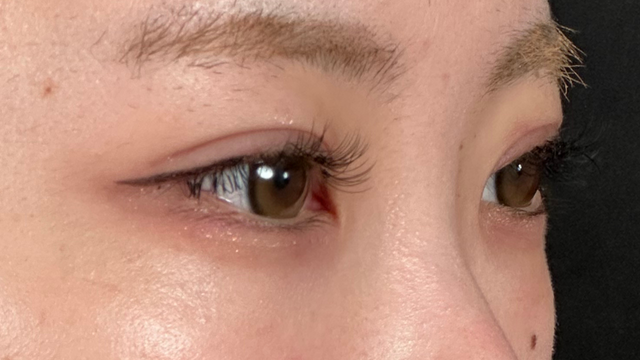 Postoperative Condition Part 1