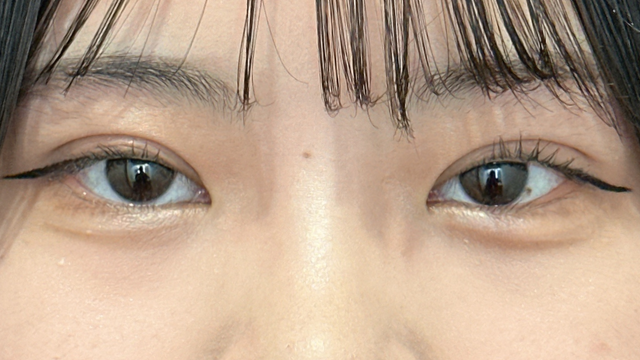 Postoperative Condition Part 1