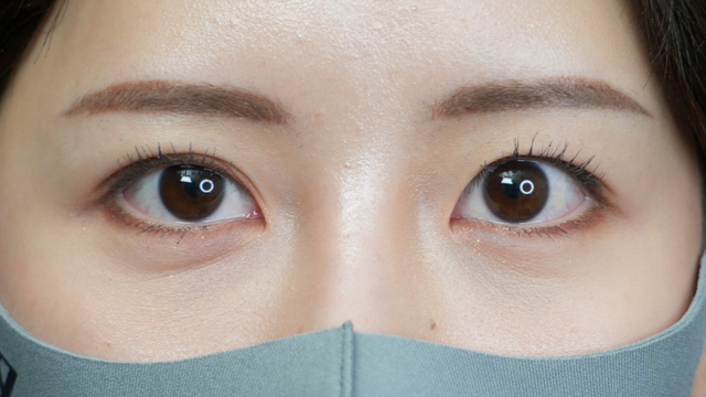 手术前的状态 其一