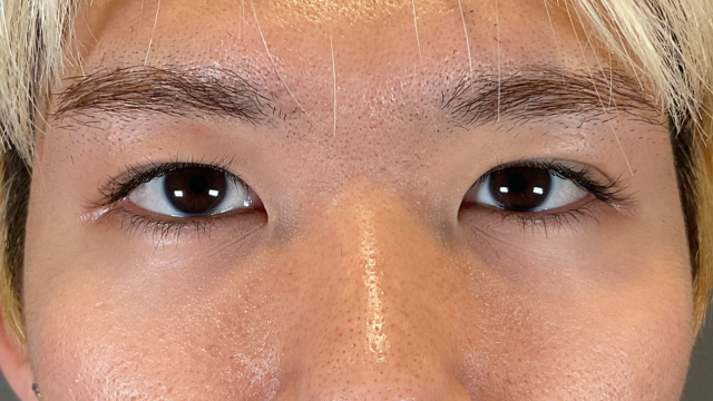 Postoperative Condition Part 1