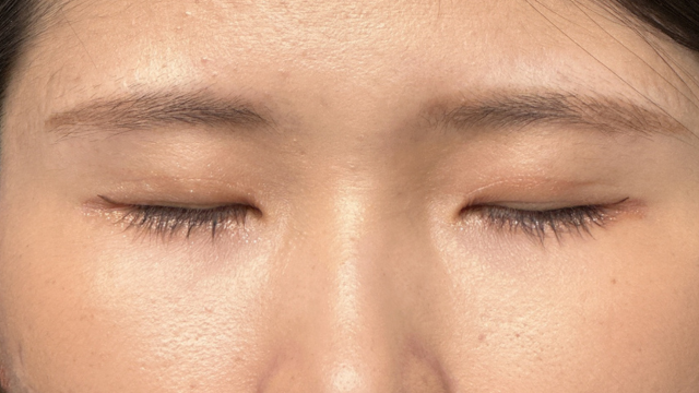 Postoperative Condition Part 1