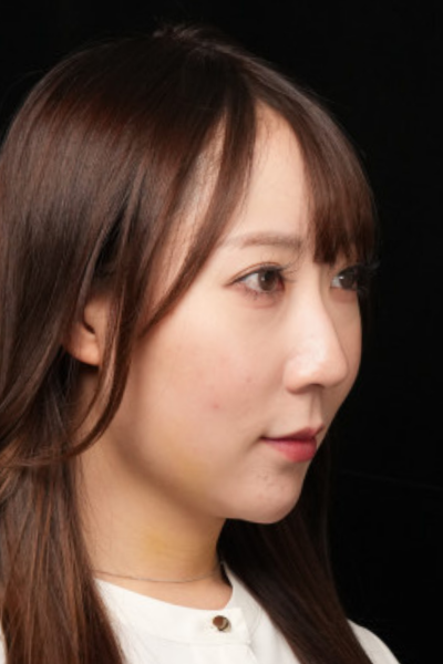 手术前的状态 其一