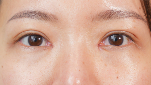 手術前の状態 その1