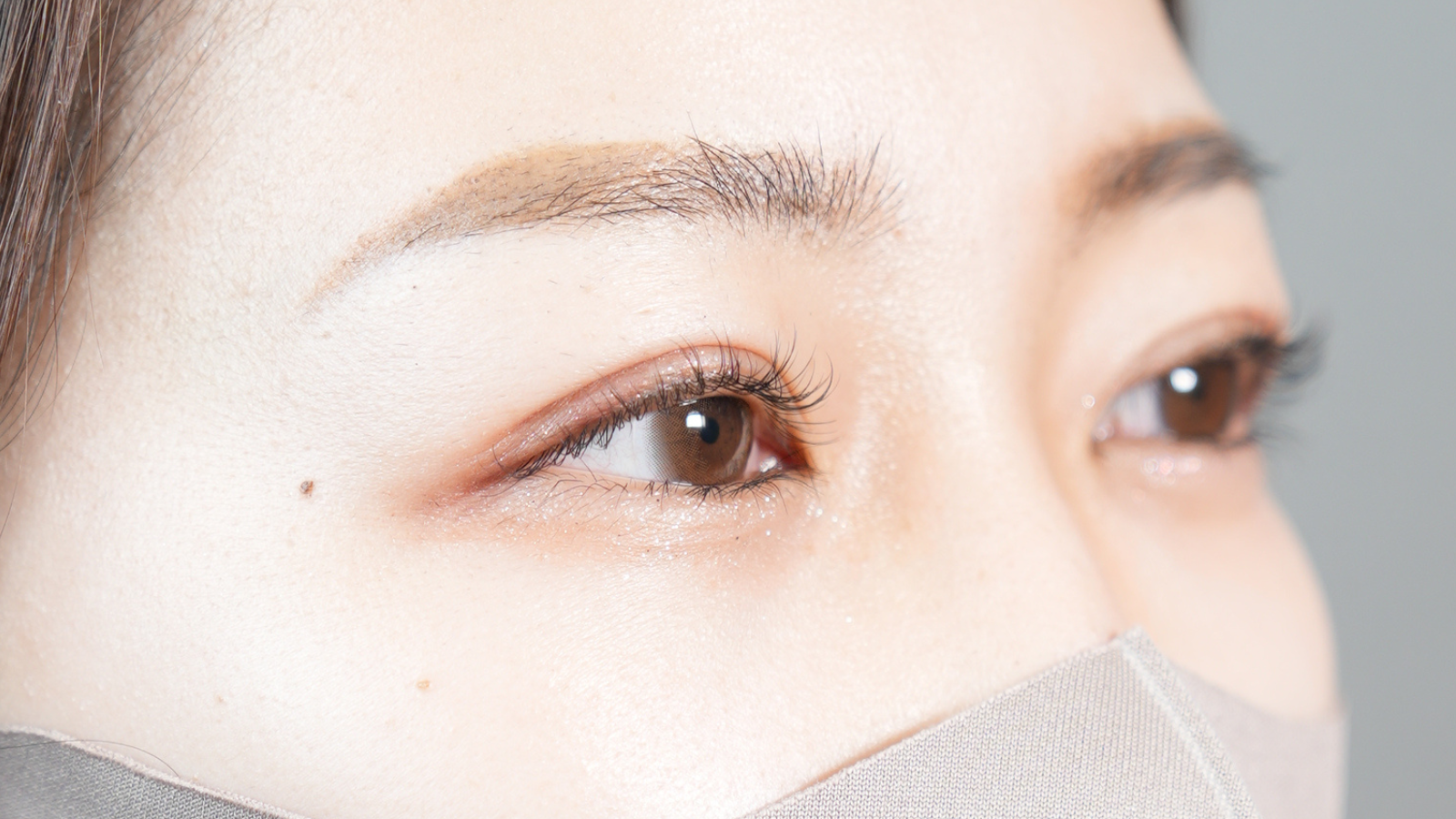 手術前の状態 その1