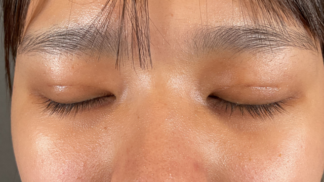 手術前の状態 その1