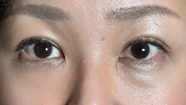 Postoperative Condition Part 1