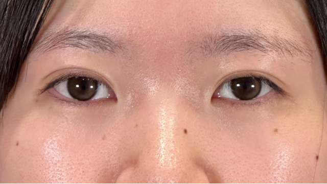 手术前的状态 其一