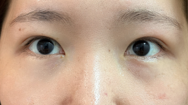 Postoperative Condition Part 1