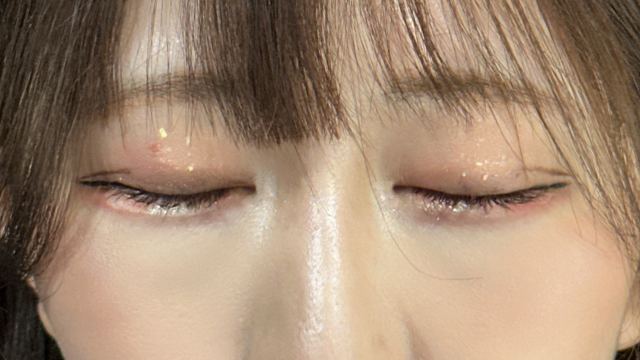 手术前的状态 其一