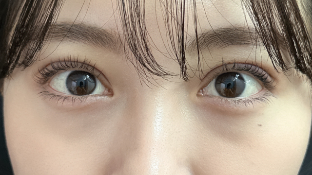 手术前的状态 其一