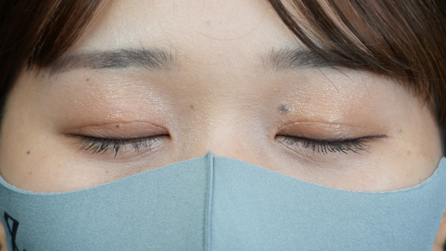 手術前の状態 その1