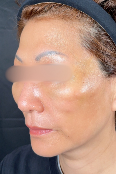 手術前の状態 その1