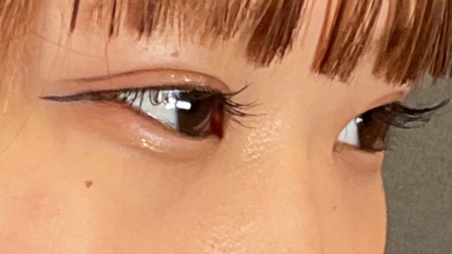 手術前の状態 その1