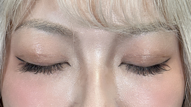 手术前的状态 其一