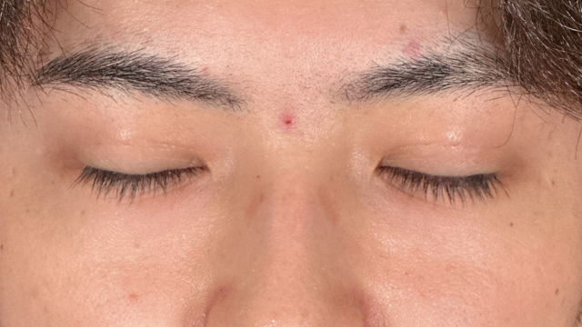 Postoperative Condition Part 1