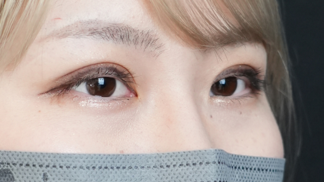 手术前的状态 其一