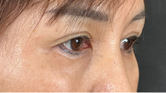 Postoperative Condition Part 1