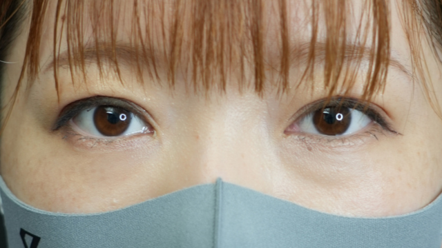 手术前的状态 其一